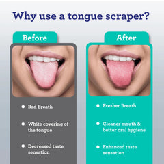 Spoon Shaped Stainless Steel Tongue Scraper – 2 Pack